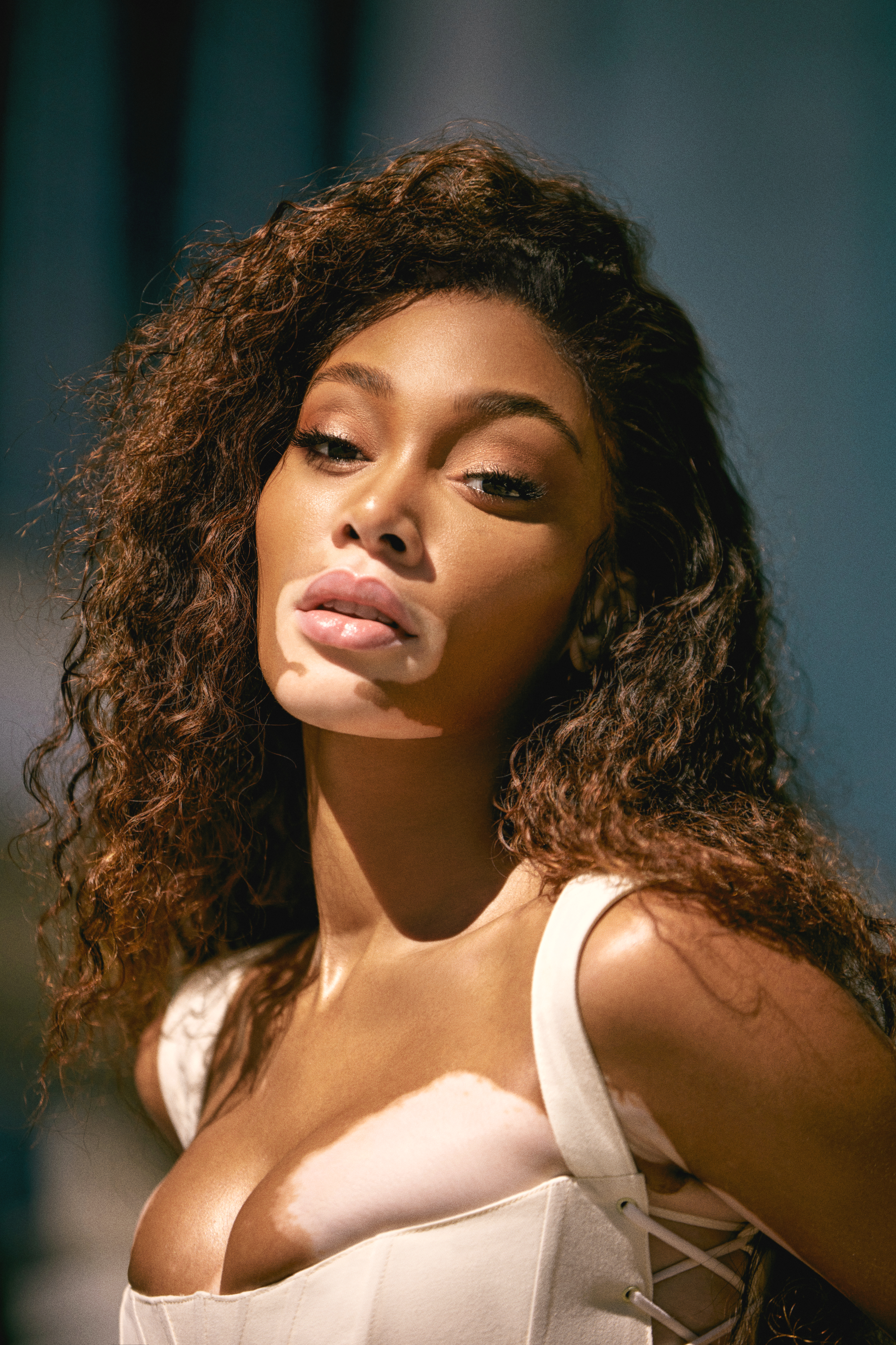 Winnie Harlow Is ‘Annoyed’ With The Algorithm, And Honestly, We Get Why