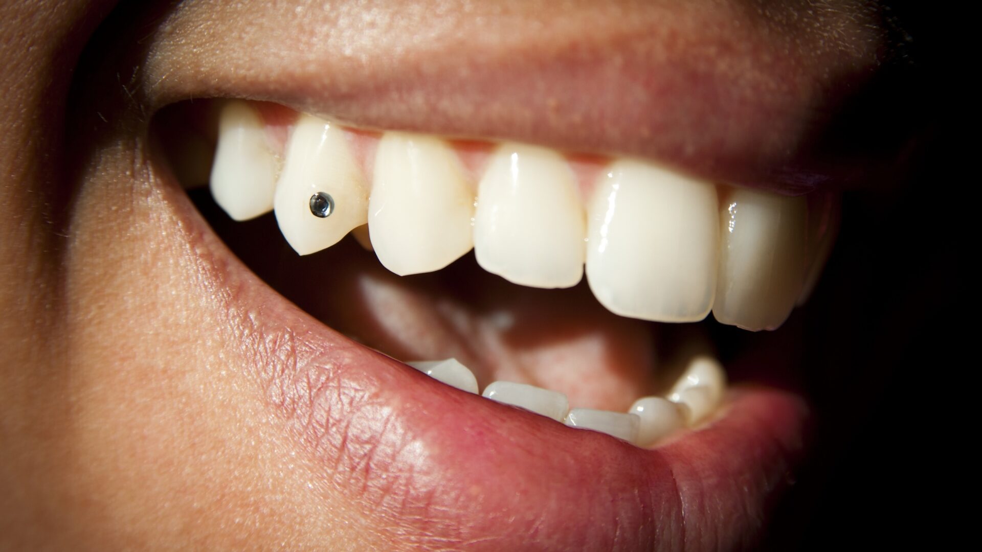 Tooth gems are back on trend and here to stay